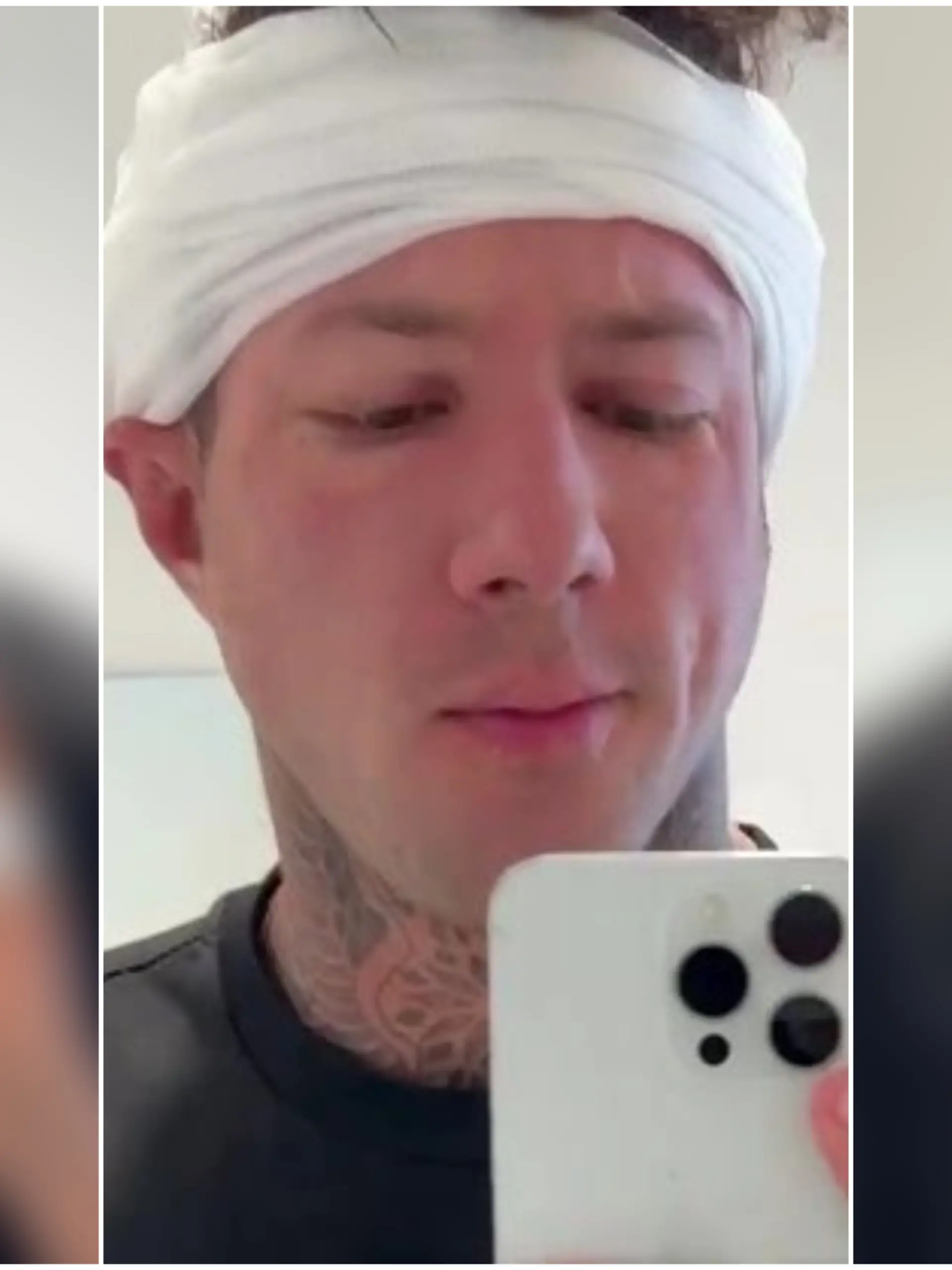 Christian Wolf hat eine Haartransplantation machen lassen.