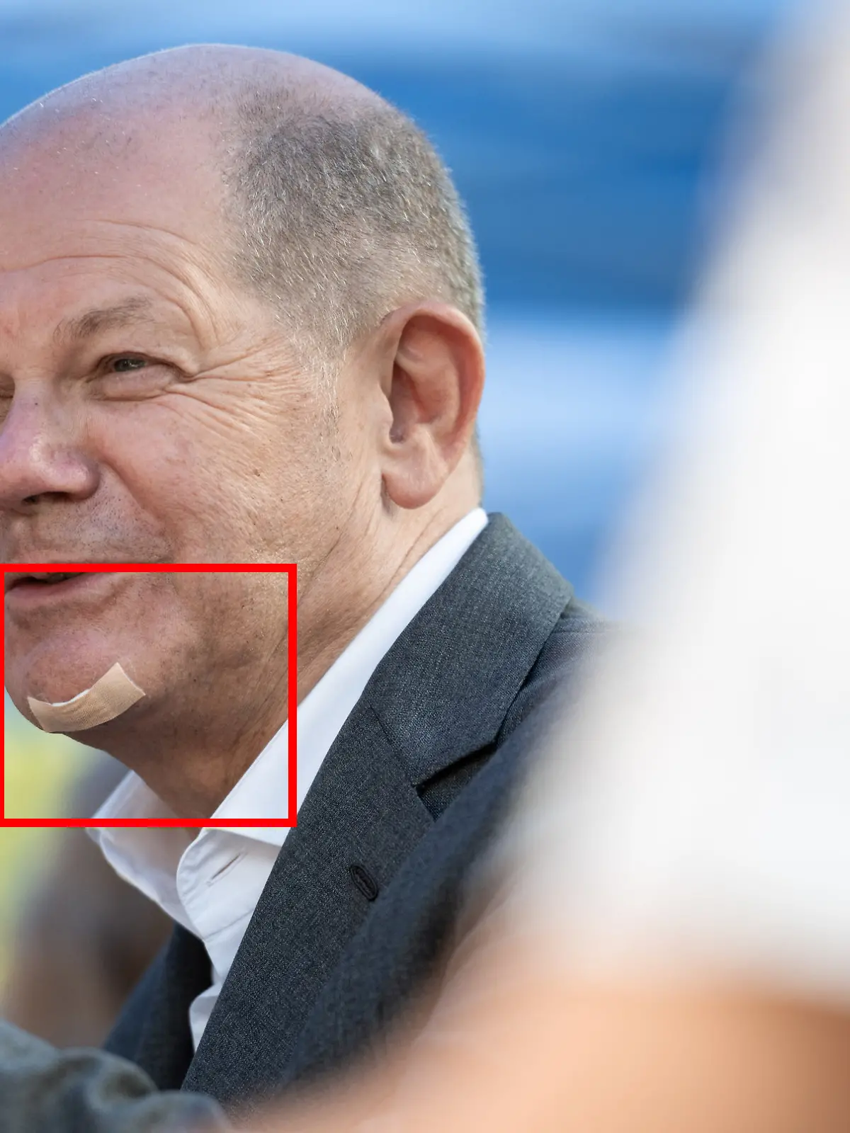Olaf Scholz mit einem Pflaster auf dem Kinn.