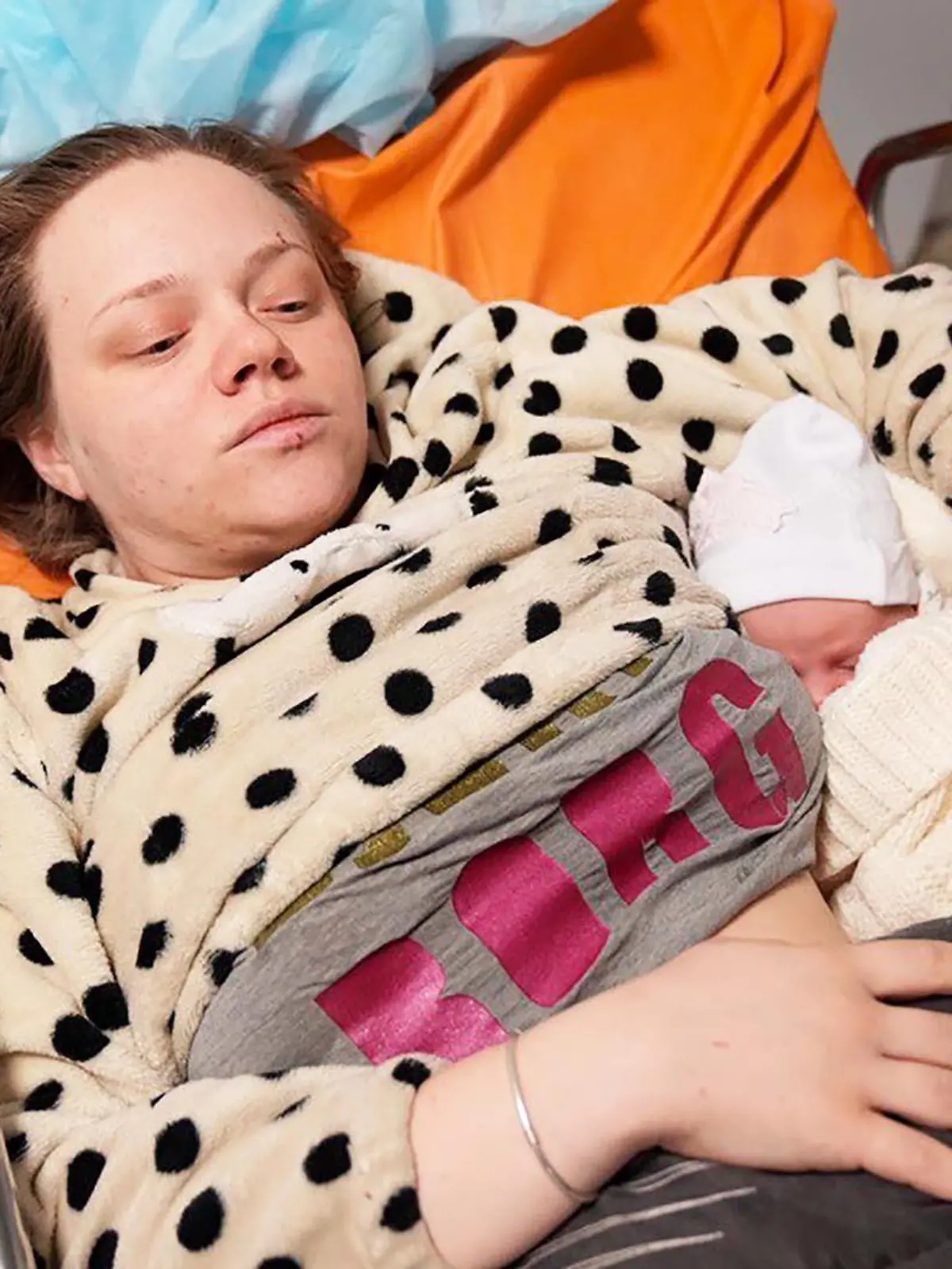 Bloggerin Mariana Vishegirskaya liegt in einem Krankenhausbett mit ihrer Tochter