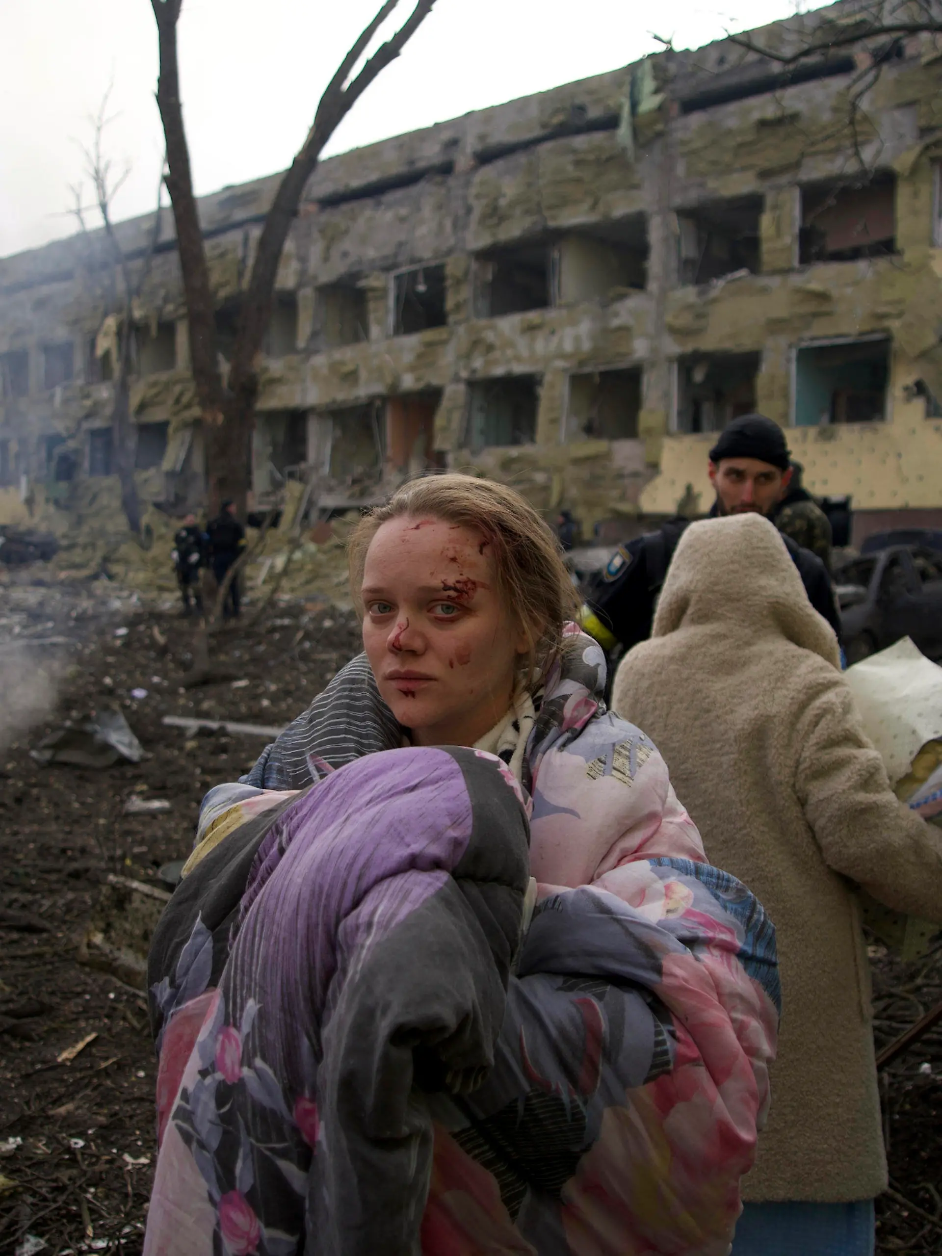 09.03.2022, Ukraine, Mariupol: Mariana Vishegirskaya steht vor einem durch Beschuss beschädigten Entbindungskrankenhaus. Vishegirskaya überlebte den Beschuss und brachte später in einem anderen Krankenhaus in Mariupol ein Mädchen zur Welt. Belagerung, Bombenhagel und kein rettender Ausweg: Die Hilferufe aus der ukrainischen Hafenstadt Mariupol - Heimat von mehr als 400 000 Menschen - werden dramatischer. Foto: Mstyslav Chernov/AP/dpa - ACHTUNG: Graphic Content +++ dpa-Bildfunk +++