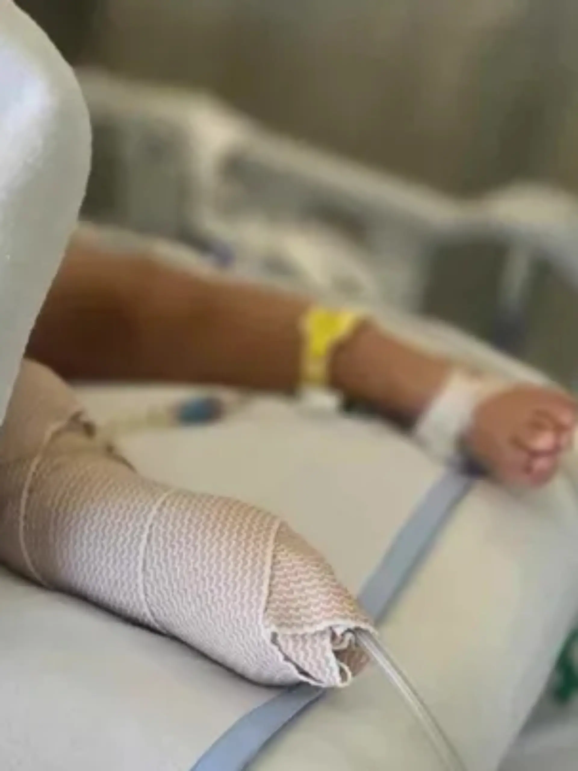 Nach dem schrecklichen Unfall wird der Junge in einem Krankenhaus in Seattle behandelt. 
