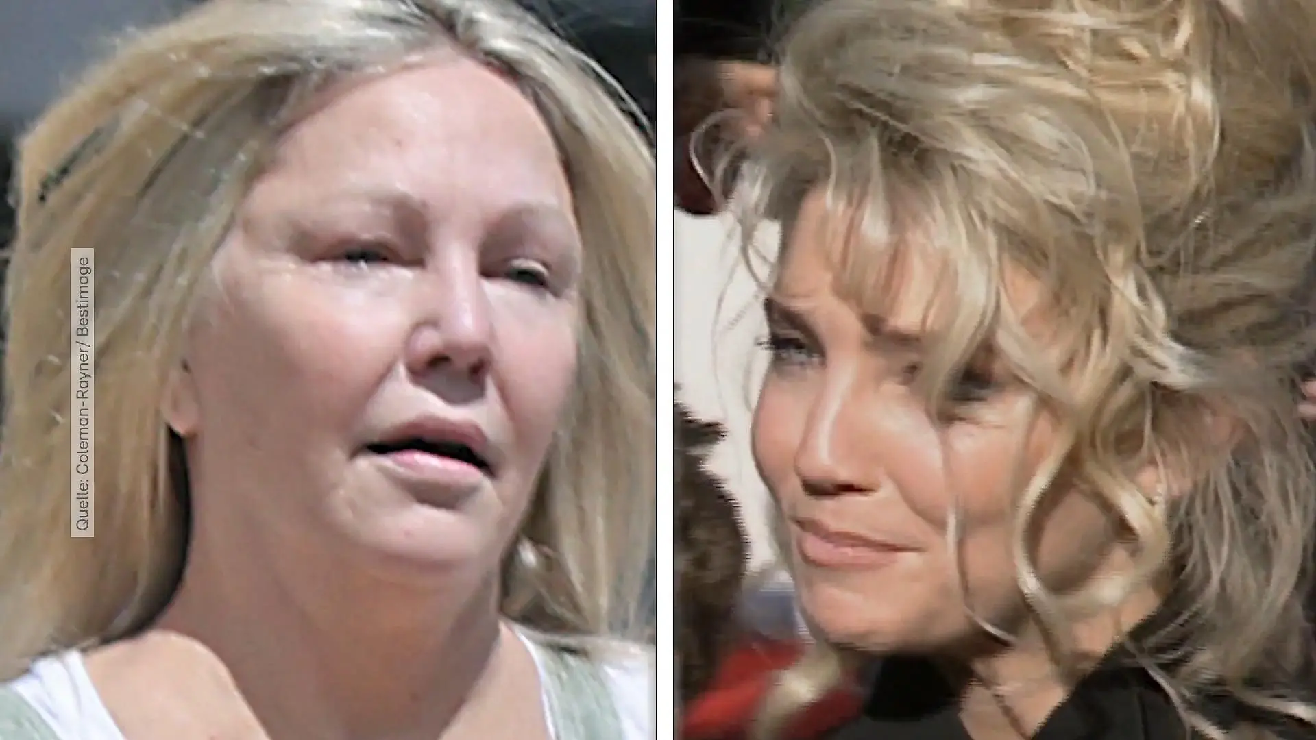Heather Locklear führt ständigen Kampf Sorge um 90ies-Serien-Star