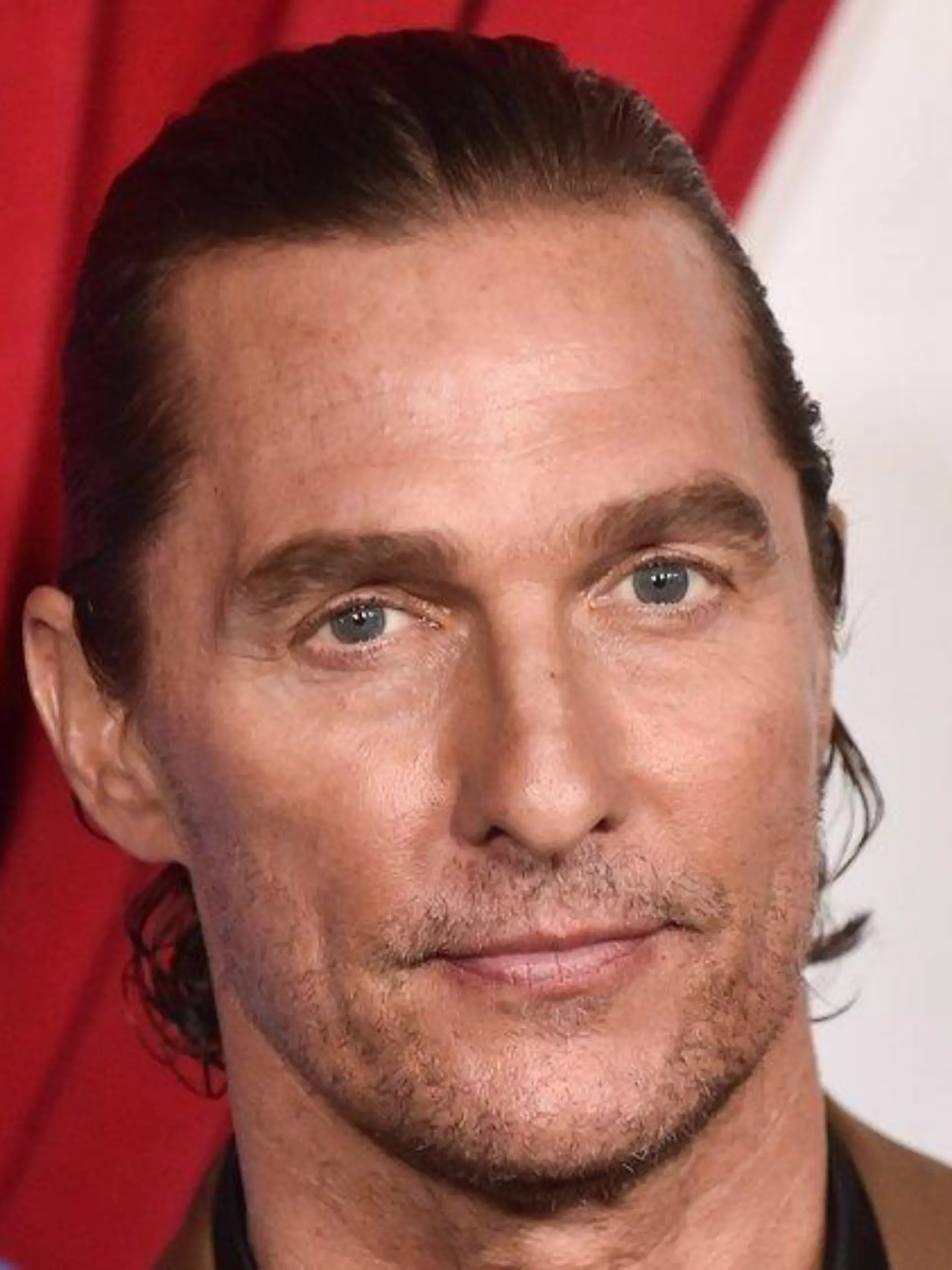 Schockbild von Matthew McConaughey: Darum ist sein Auge zugeschwollen