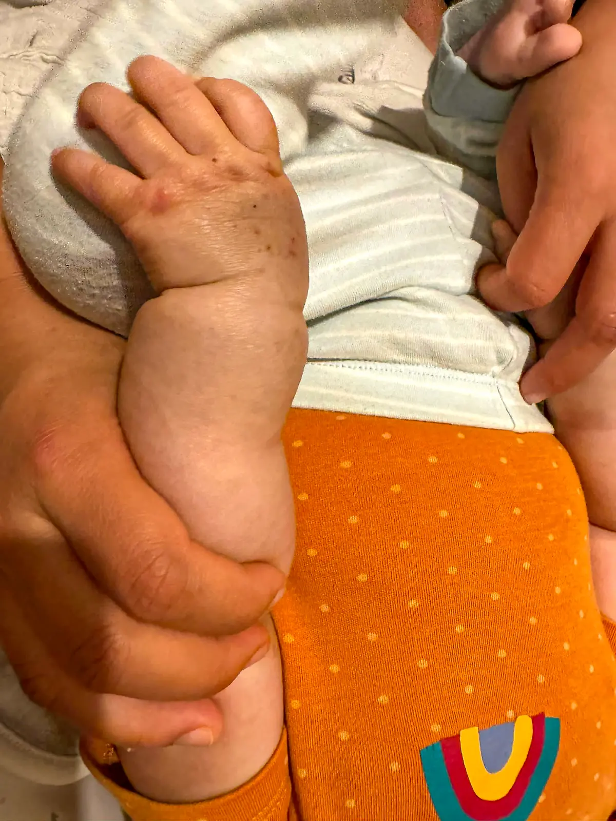 Bild zu: "Baby hat Geburtsmale - Mutter verhaftet! "