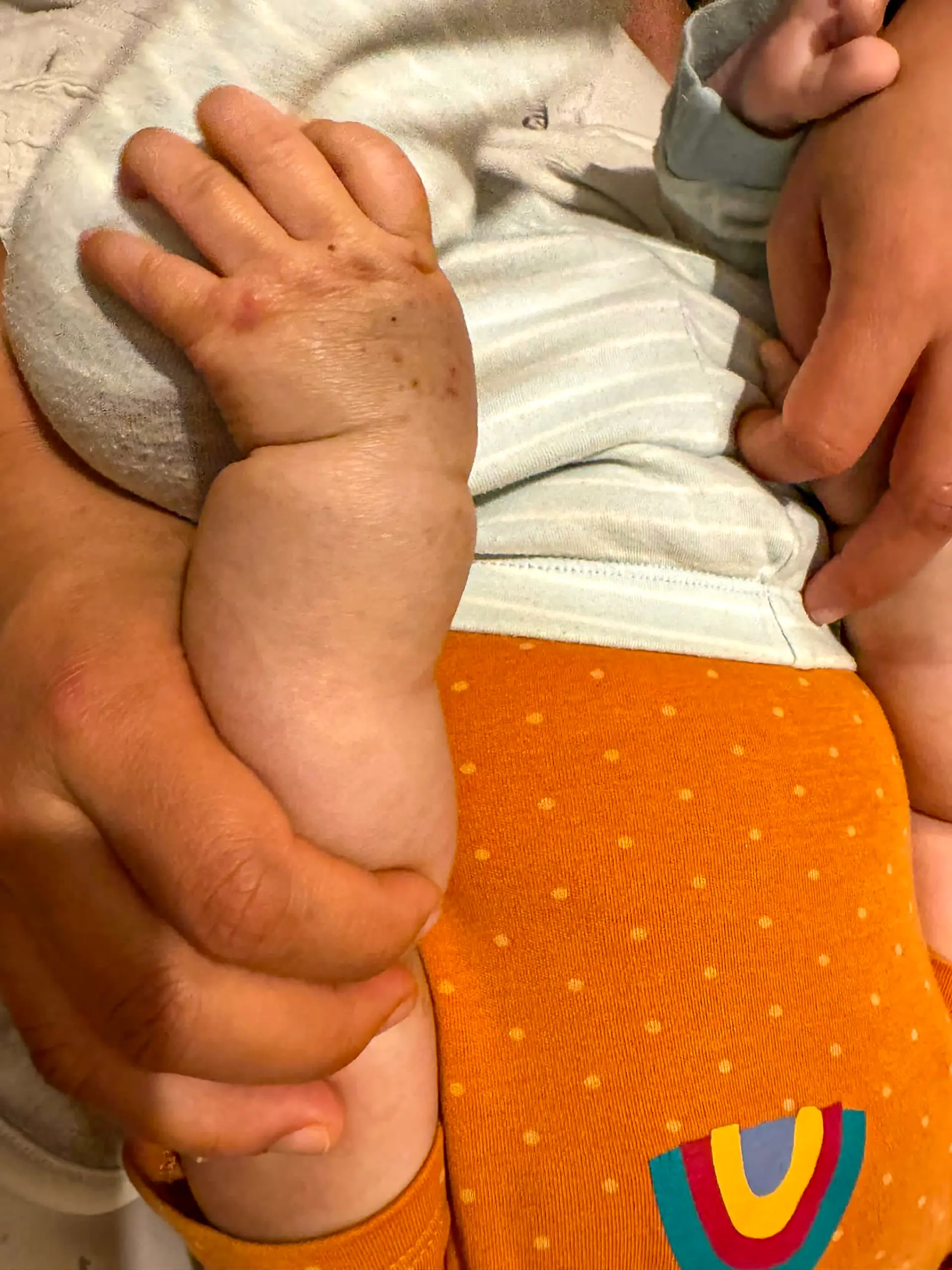 Bild zu: "Baby hat Geburtsmale - Mutter verhaftet! "