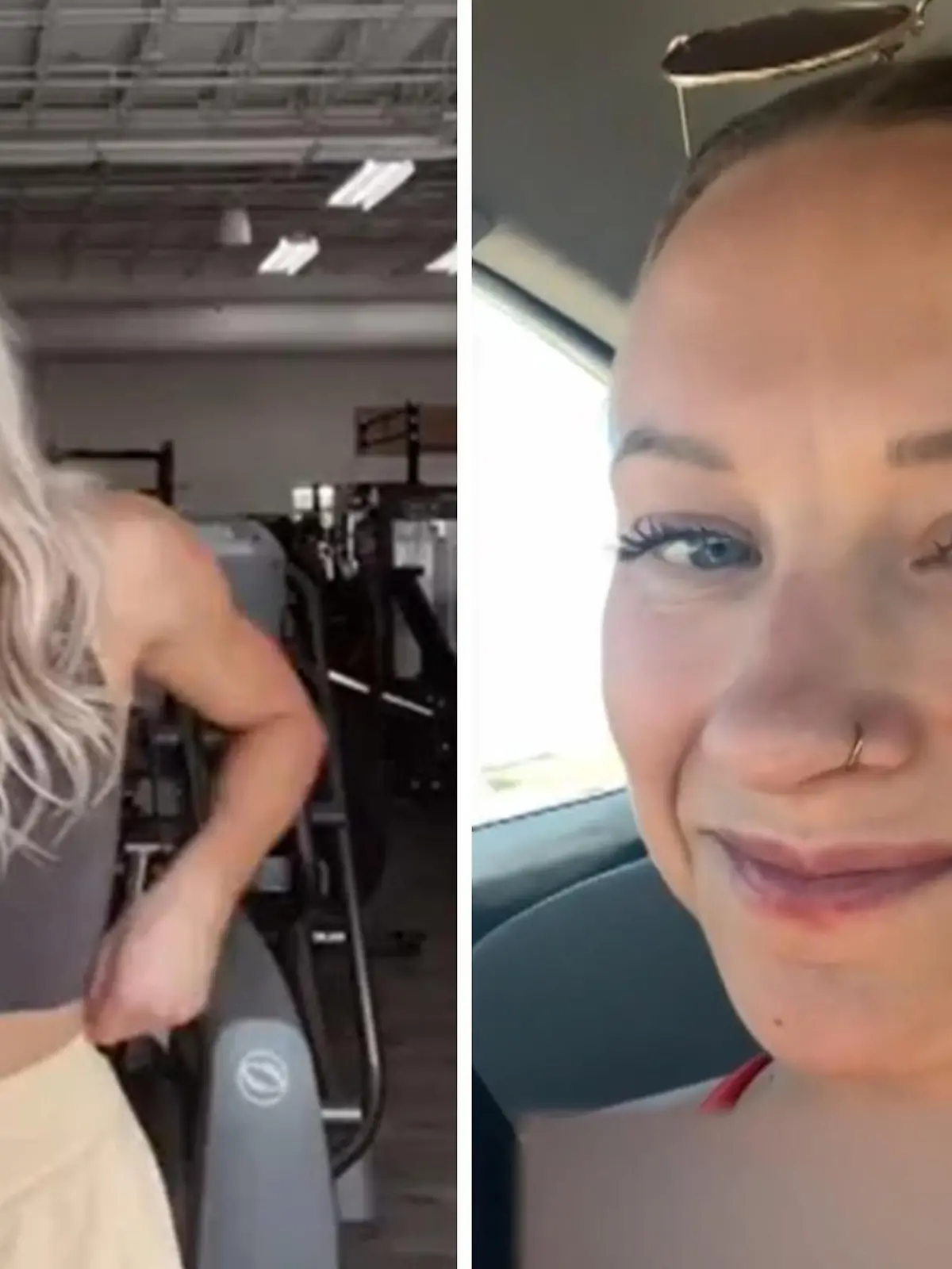 Bild zu: "Influencerin (25) zeigt sich ohne Filter - Shitstorm!"