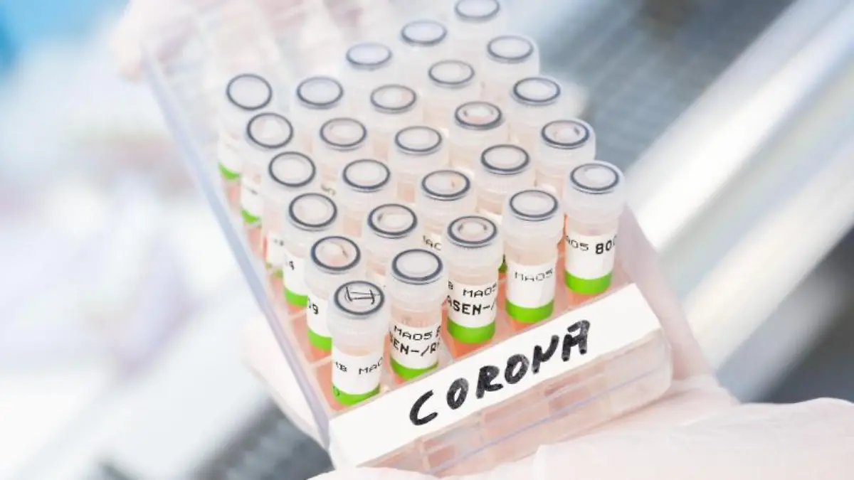 Coronavirus Laborbild