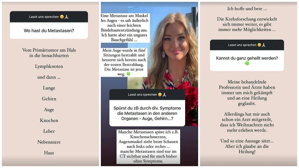 Patrice Aminati macht vielen Menschen mit ihrer Offenheit großen Mut und gilt als Inspiration.