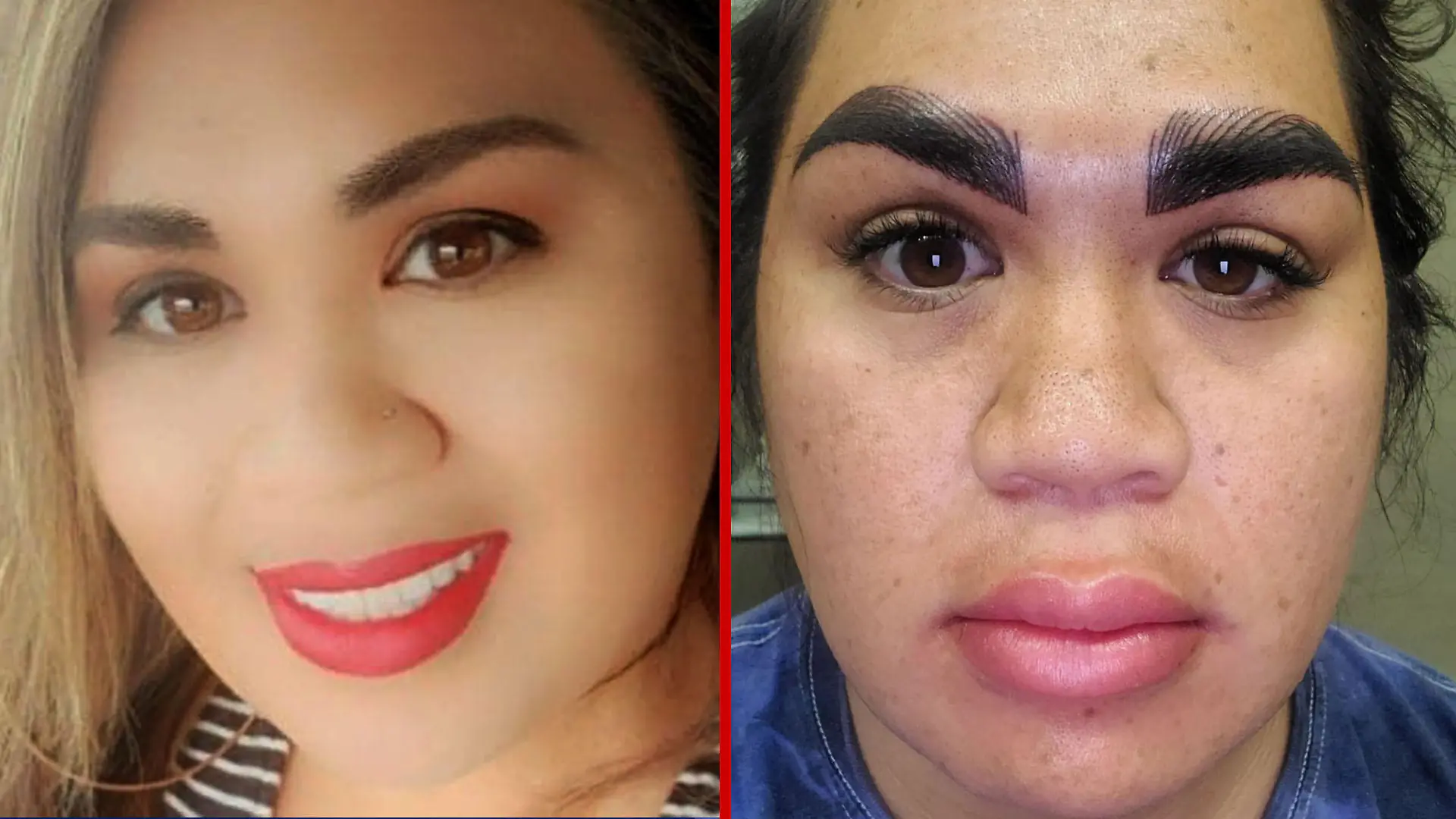 Crystals Augenbrauen bedecken nach einer Permanent Make-up Sitzung fast ihre halbe Stirn.