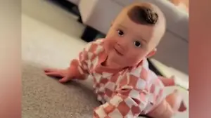 Lulu kommt mit gefährlichem Gendefekt zur Welt Mit XXL-Muttermal geboren?