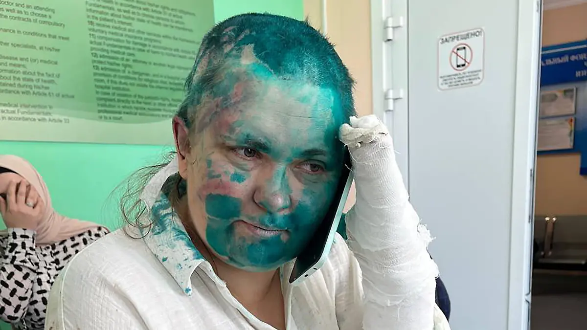 RUSSIA, GROZNY - JULY 4, 2023: Journalist Yelena Milashina is seen in a hospital after being attacked by unknown men. Journalist Yelena Milashina and lawyer Alexander Nemov were attacked by unidentified men as they came to Grozny for a trial of Zarema Musayeva; both Milashina and Nemov have numerous fractures, Nemow was also stabbed. Sergei Babinets/TASS / action press