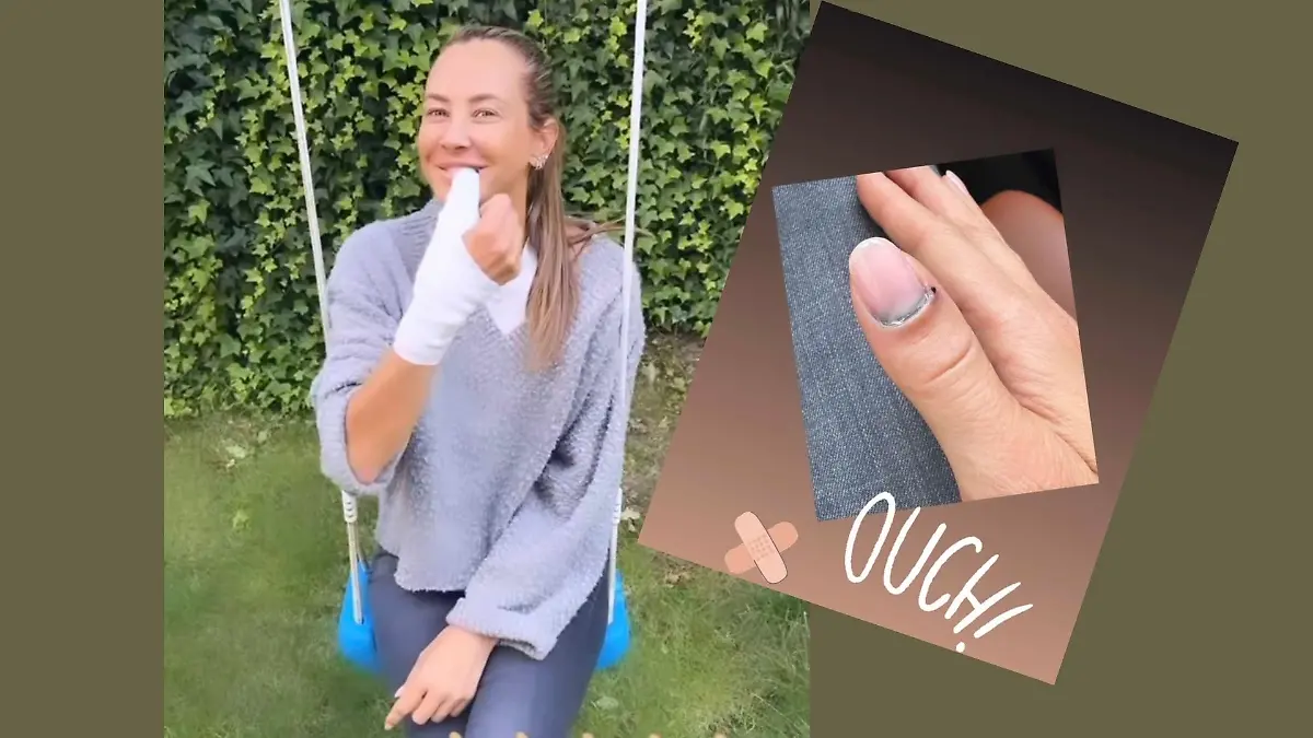 Sandy Meyer-Wölden hat sich den Daumen gebrochen