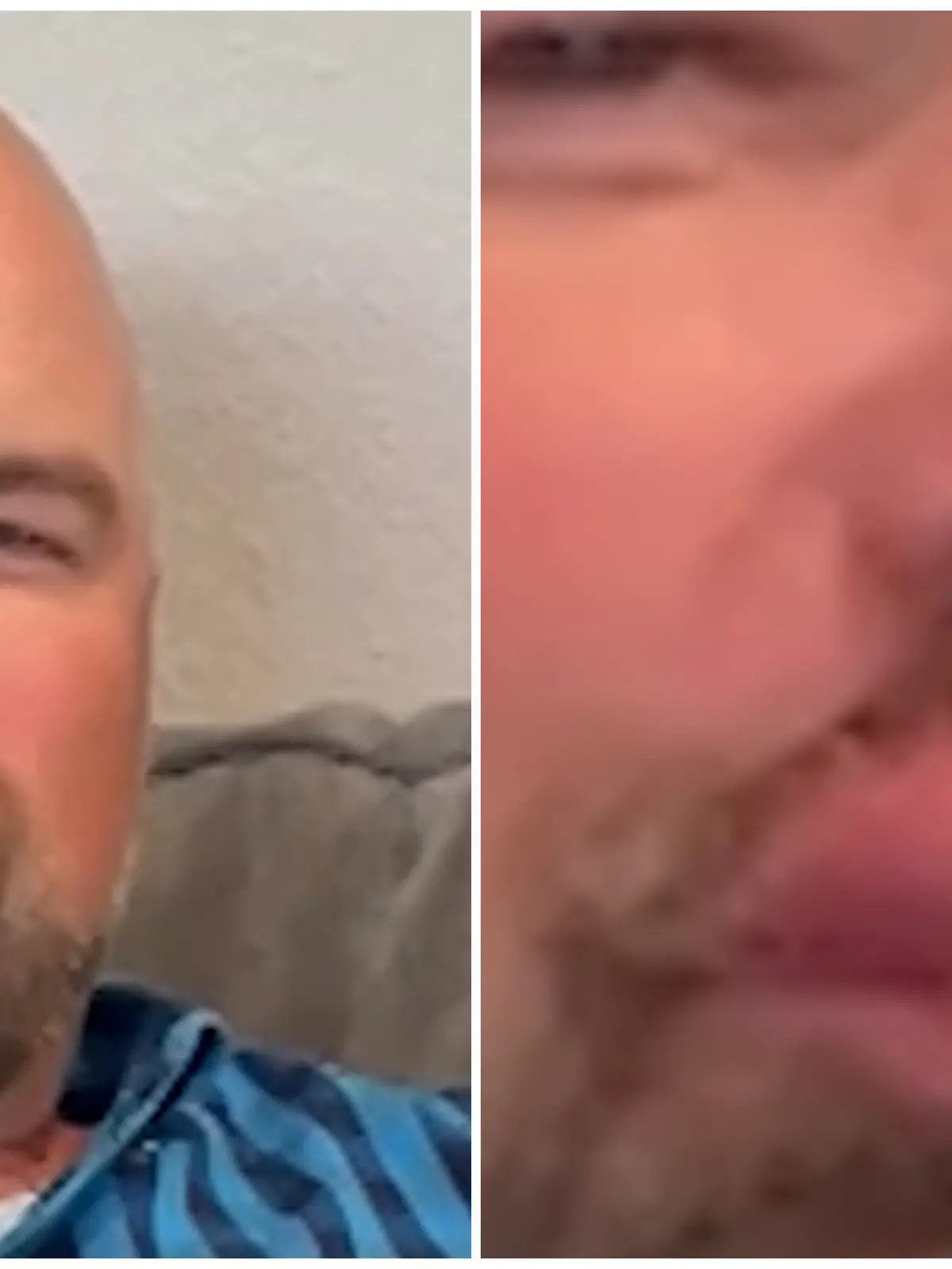 Fotokollage: links zwinkert der Mann, rechts die Lippe als Nahaufnahme