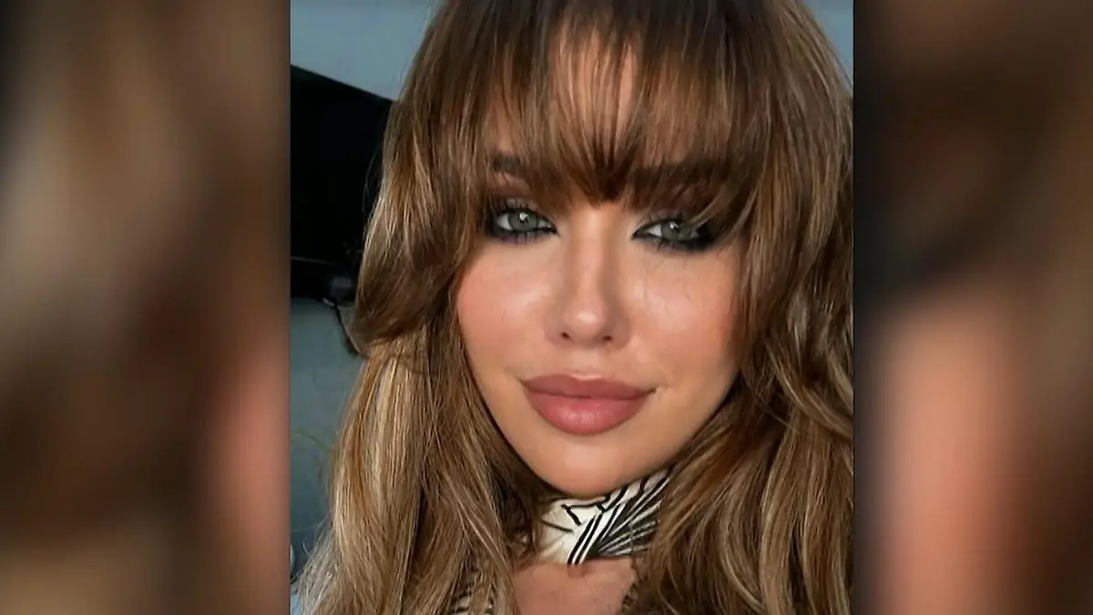 Kim Gloss präsentiert sich mit neuem Look Nach Hirn-OP