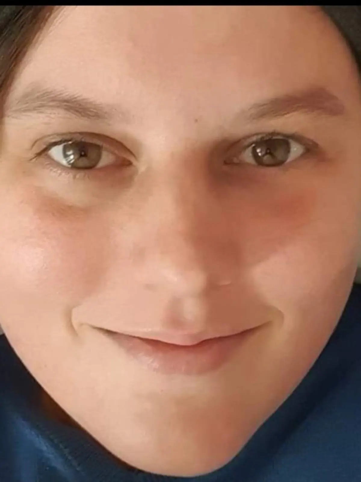 Yvonne Arnold (39)  leidet an der mysteriösen Krankheit ME/CFS