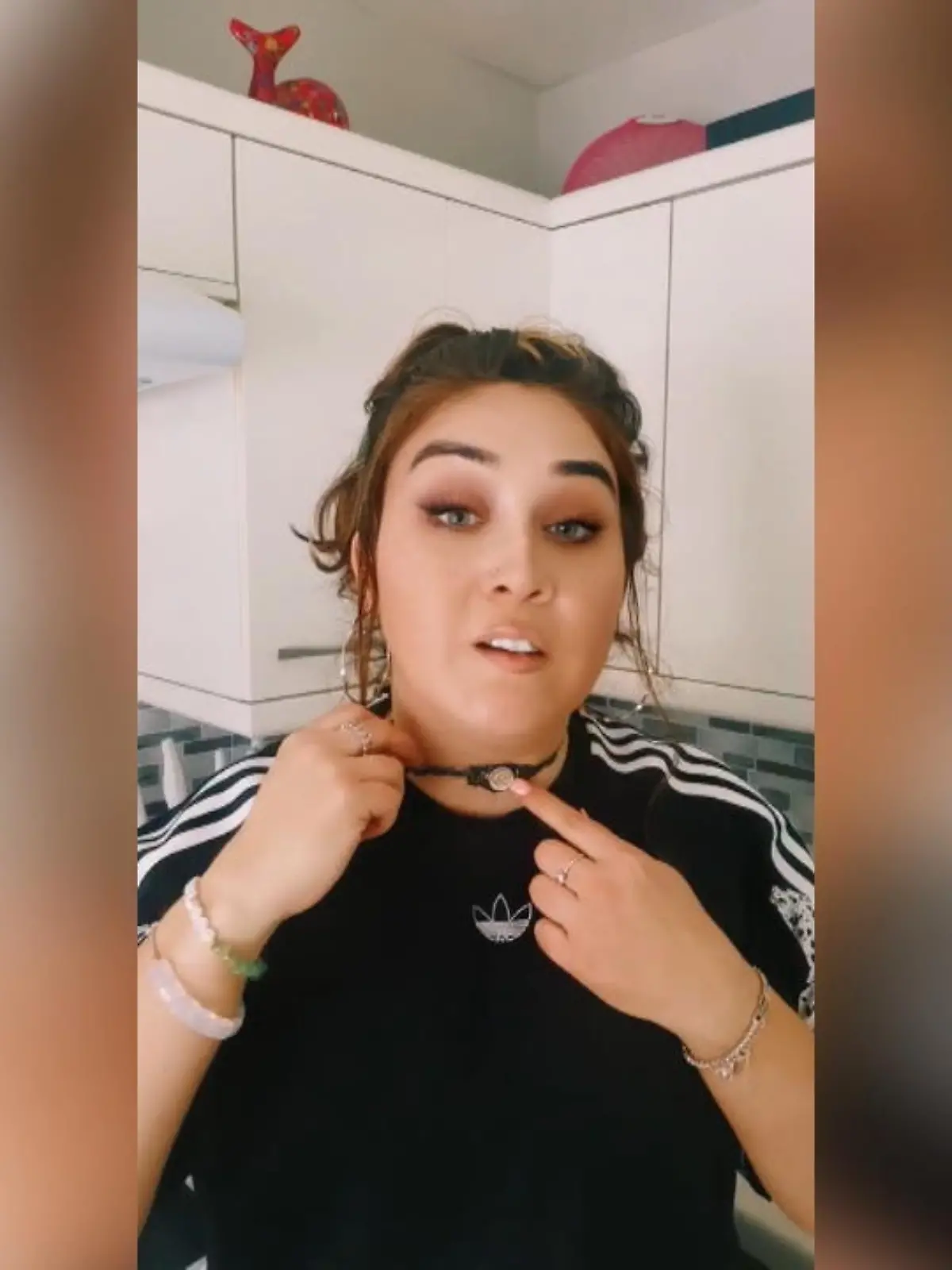 Alexandra (31) hat das Pierre-Robin-Syndrom, aber statt sich zu verstecken, will sie ihren Followern zeigen, was das bedeutet.