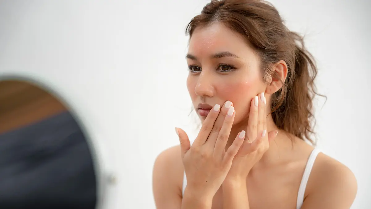 Young woman are worried about faces Dermatology and allergic to steroids in cosmetics. sensitive skin, red face from sunburn, acne, allergic to chemicals, rash on face. skin problems and beauty