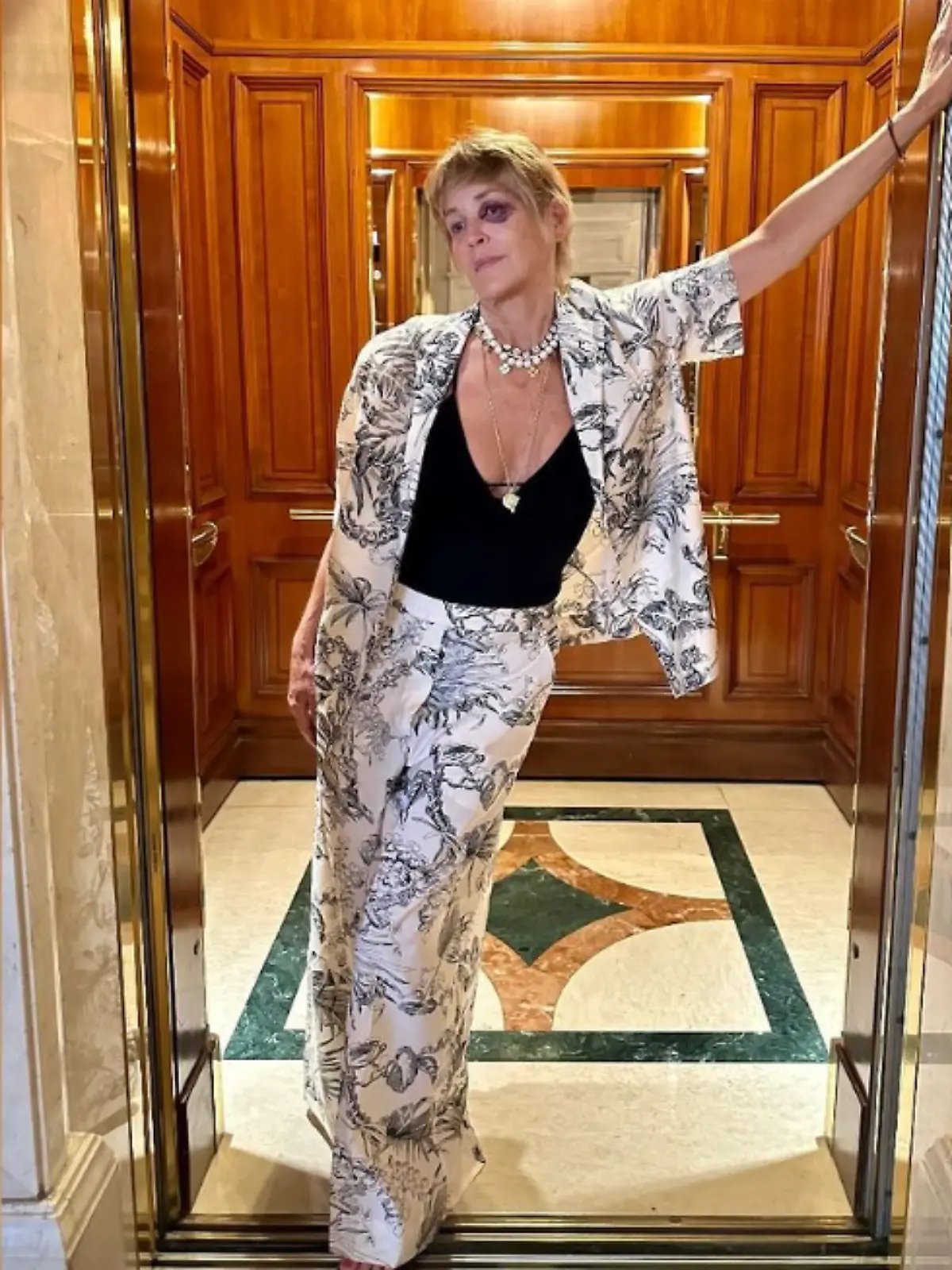 Sharon Stone mit blauem Auge