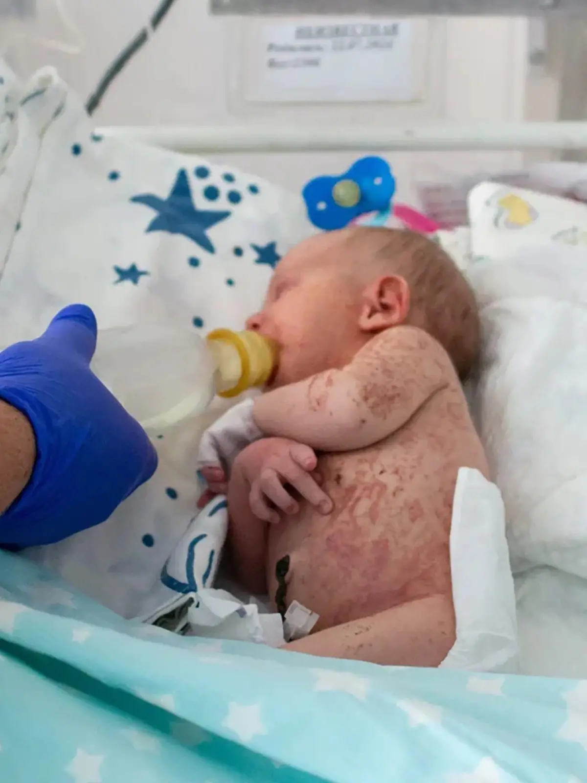 Ein kleines Baby im Krankenhaus. 