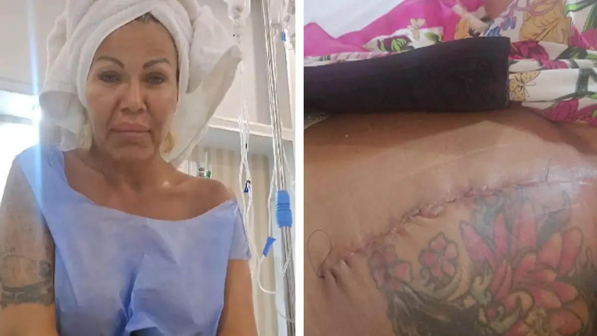 Darmverschluss! Not-OP für Ginger Wollersheim im Urlaub "Das wünsche ich niemandem!"