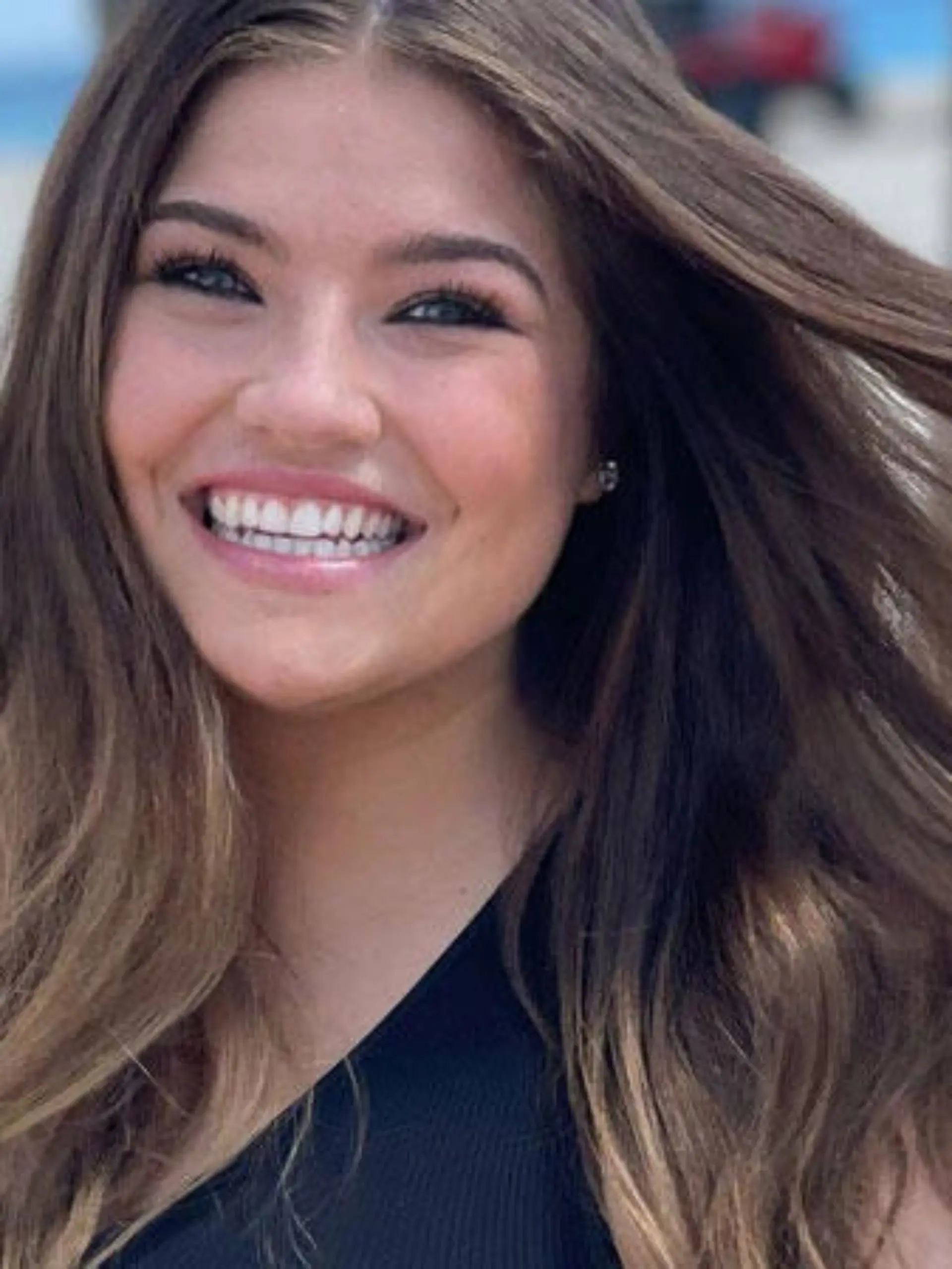 Große Brüste sind doch toll? Die US-Amerikanerin Renée Smith (24) sieht das anders.