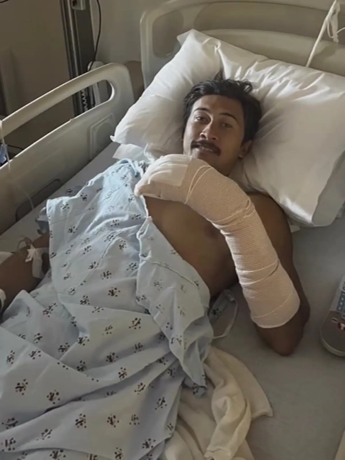 CJ Lyles mit dick bandagierter Hand im Krankenhaus 