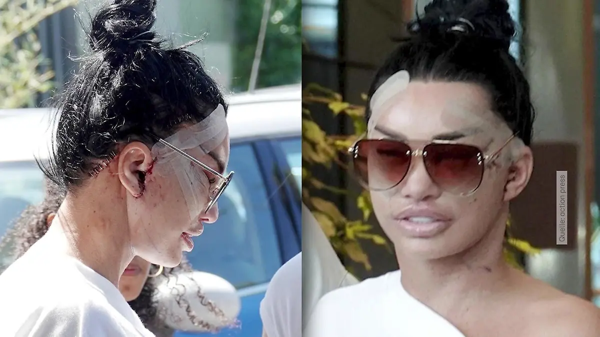 Nach Beauty-OP schockt Katie Price jetzt mit diesen Fotos Autsch!