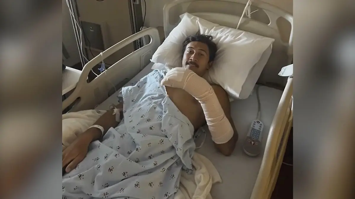 Hai beißt Surfer blutig! Mann (31) muss sich losreißen Attacke bis auf die Knochen!