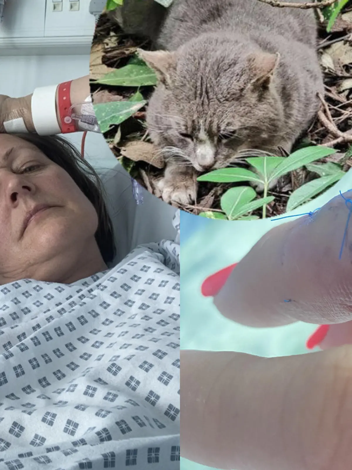 Verletzter Finger, Frau und Katze auf einem Bild