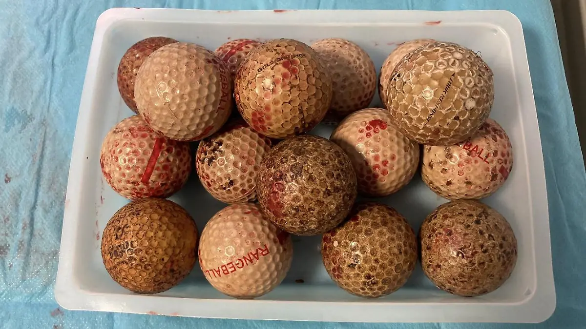 SONDERKONDITIONEN: Satzpreis!
Sixteen golf balls that were removed from Boxer dog Ben's stomach during surgery. A greedy dog was left feeling below par after swallowing 16 GOLF BALLS. See SWNS story SWMDdog. Ben the Boxer was rushed into emergency surgery after the cluster of 4cm wide balls were found lodged in his stomach. Stunned vets in Runcorn, Cheshire, were forced to carry out a two-hour operation to save the two-year-old pooch. Dylan Payne, surgeon at Northwest Veterinary Specialists, said: ?We performed an endoscopy of the stomach which revealed a large blockage due to golf balls ? lots of golf balls. ?Ben?s stomach was very full so we needed to carry out an urgent surgery to open the stomach to allow us to remove the balls. ?It?s fairly routine, low risk surgery but the removal of so many golf balls is unique. Sixteen is a lot, even for a Boxer. ?The operation was a complete success and Ben is back at home doing very well and gaining weight.? Ben?s owner David Warren, 70, first noticed his beloved pooch was feeling rough two months ago when he started losing weight.
/ action press