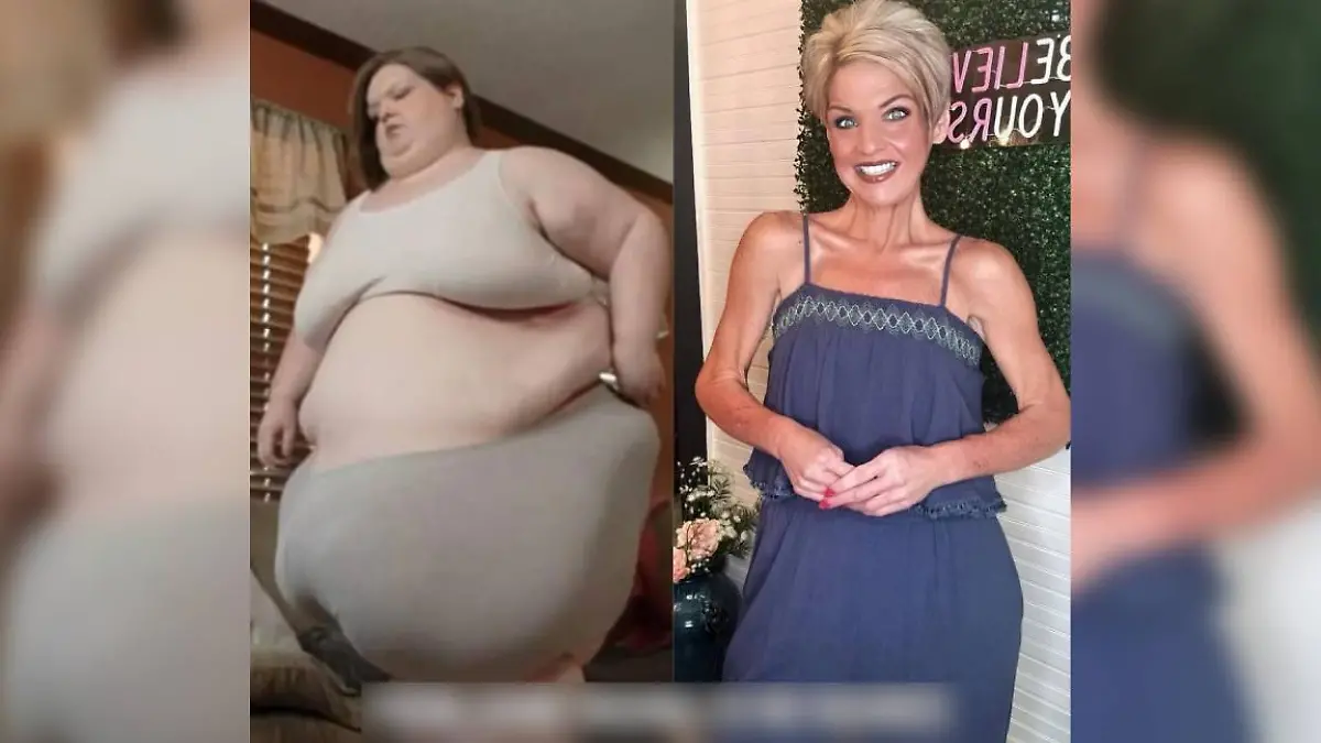 Amanda Johnson vor und nach ihrem Gewichtsverlust