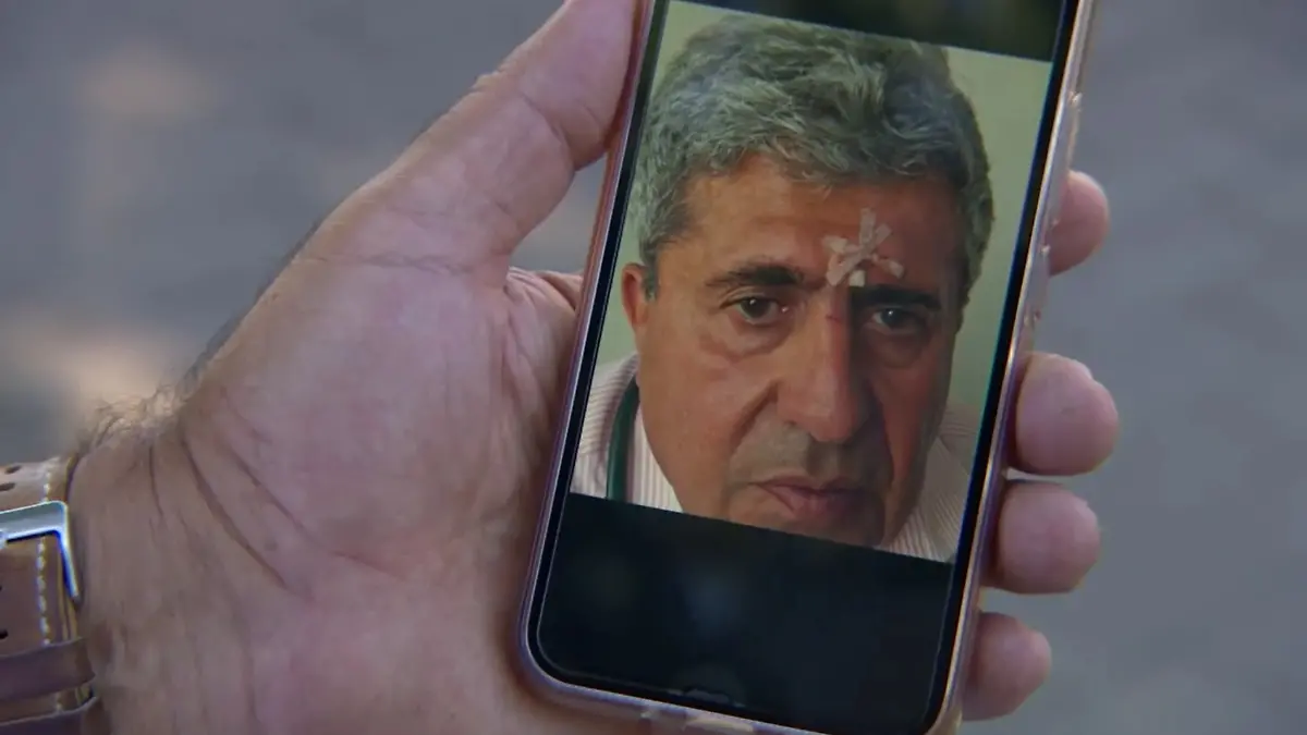 Amin Ballouz zeigt RTL seine Wunde am Kopf.