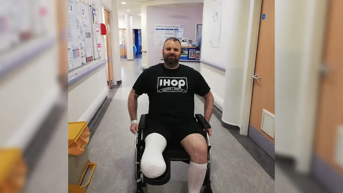 Mark Willerton (50), ein Klempner aus Großbritannien, sitzt im Rollstuhl, nachdem sein Bein amputiert werden musste.