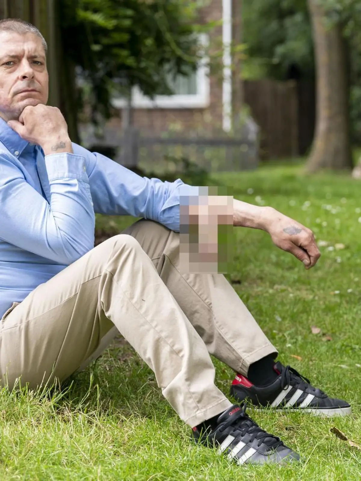 EXCLUSIVE! SONDERKONDITIONEN! DOPPELTER ANSTRICH! MINDESTHONORAR ? 200.- / Malcolm MacDonald,45, was devastated when his penis dropped off following a horror infection in 2014. A top doctor grafted a new one onto his arm until it was ready to attach. 

Material must be credited "The Sun/News Licensing" unless otherwise agreed. 100% surcharge if not credited. Online rights need to be cleared separately. Strictly one time use only subject to agreement with News LicensingEXCLUSIVE! SONDERKONDITIONEN! DOPPELTER ANSTRICH! MINDESTHONORAR ? 200.- / Malcolm MacDonald,45, was devastated when his penis dropped off following a horror infection in 2014. A top doctor grafted a new one onto his arm until it was ready to attach. (VIDEO vorhanden)

Material must be credited "The Sun/News Licensing" unless otherwise agreed. 100% surcharge if not credited. Online rights need to be cleared separately. Strictly one time use only subject to agreement with News Licensing