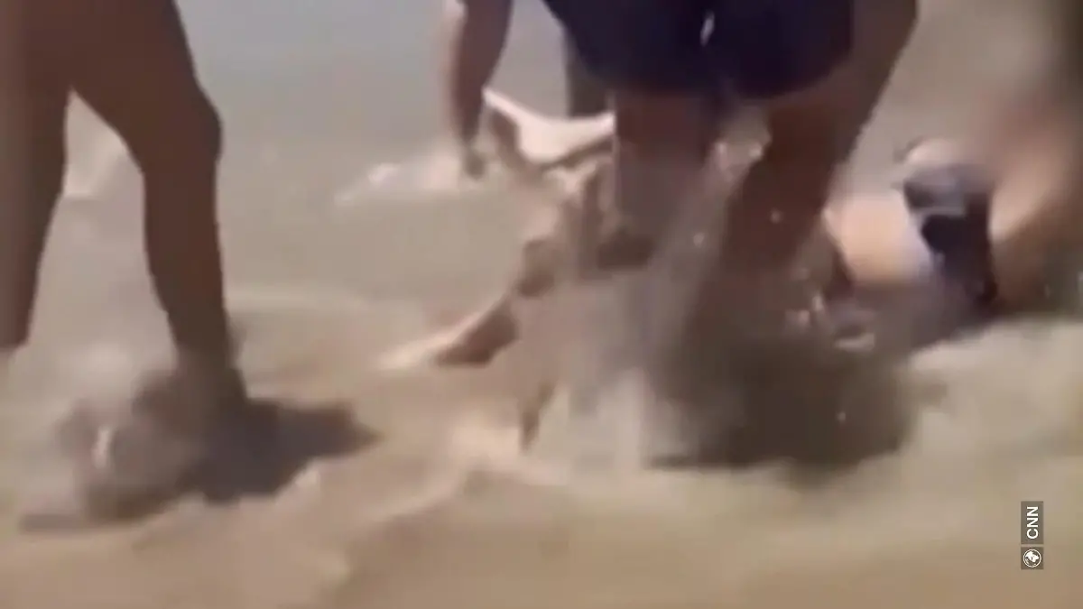 Shark tears leg apart! Woman pulled bleeding from sea, husband rushes to help