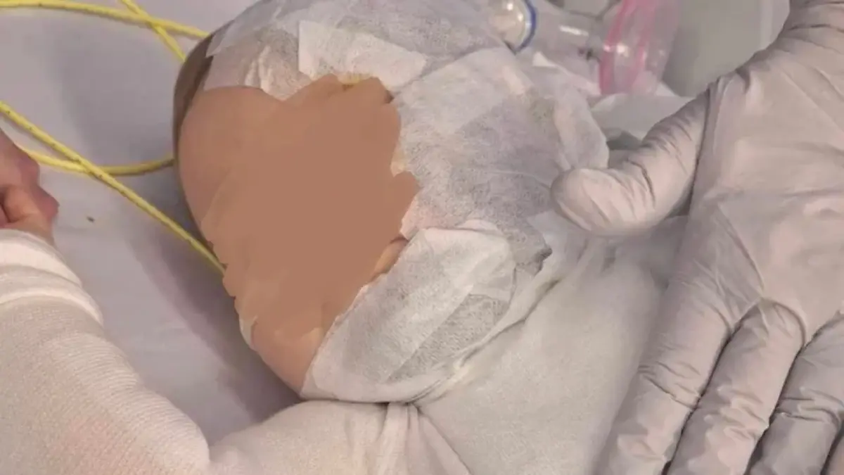 Baby mit Kaffee übergossen