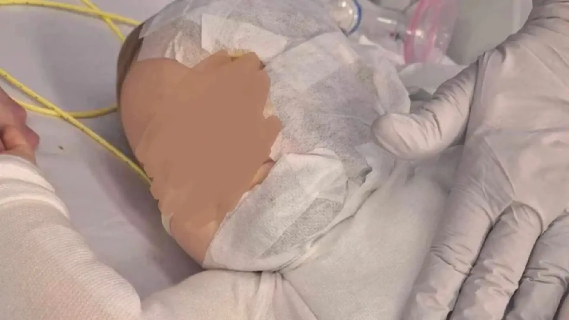 Baby mit Kaffee übergossen