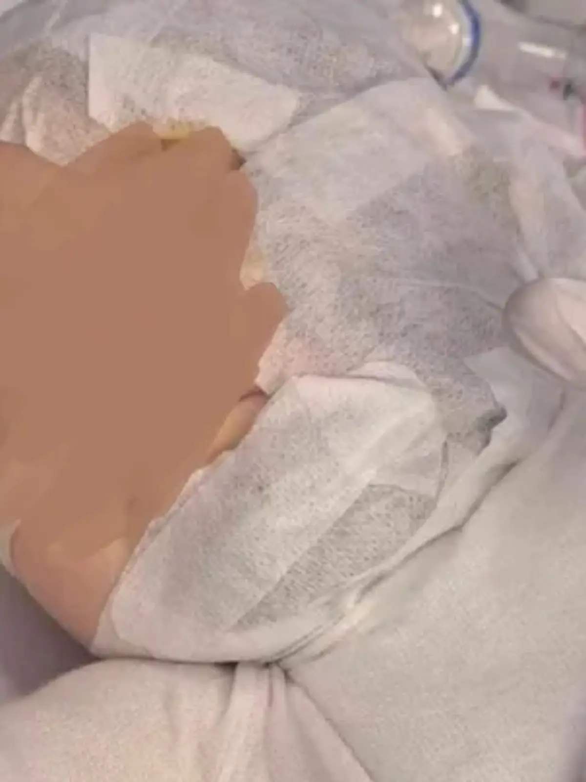 Baby mit Kaffee übergossen