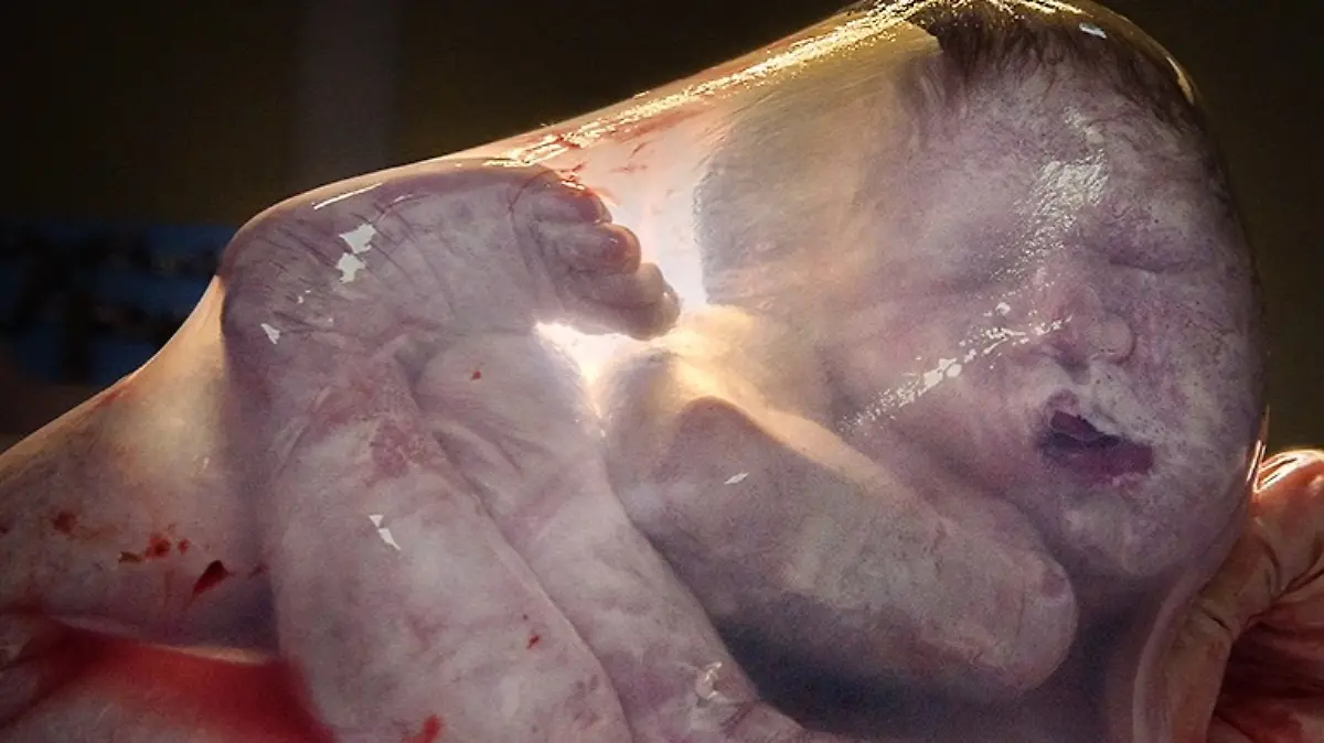 Körper eines neuen Erdenbürgers befindet sich noch vollständig in der Fruchtblase.