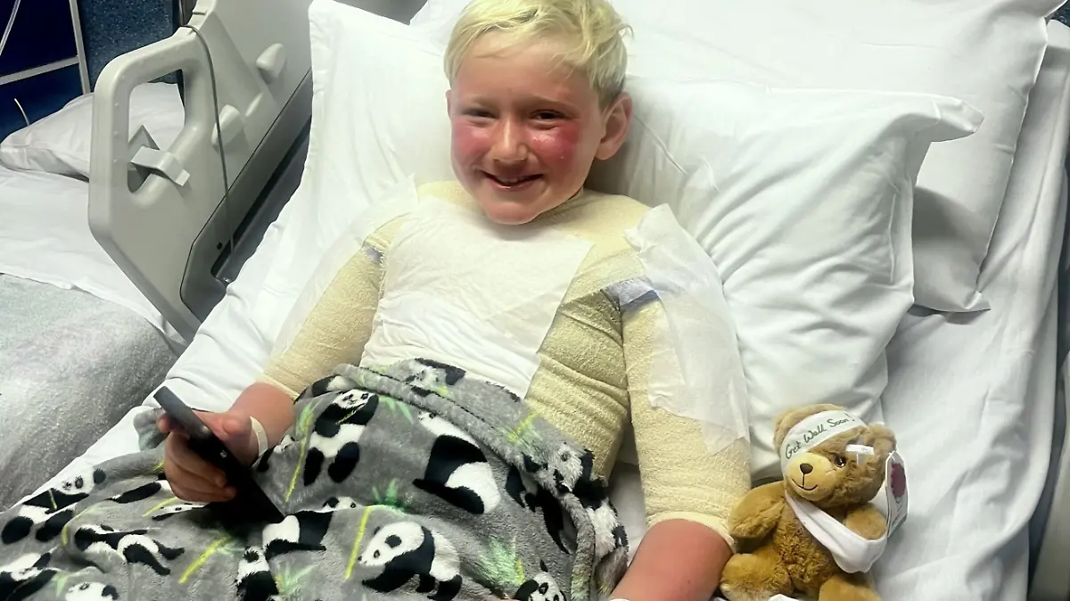 Fake-Sonnenmilch! Junge (10) mit üblen Verbrennungen im Krankenhaus