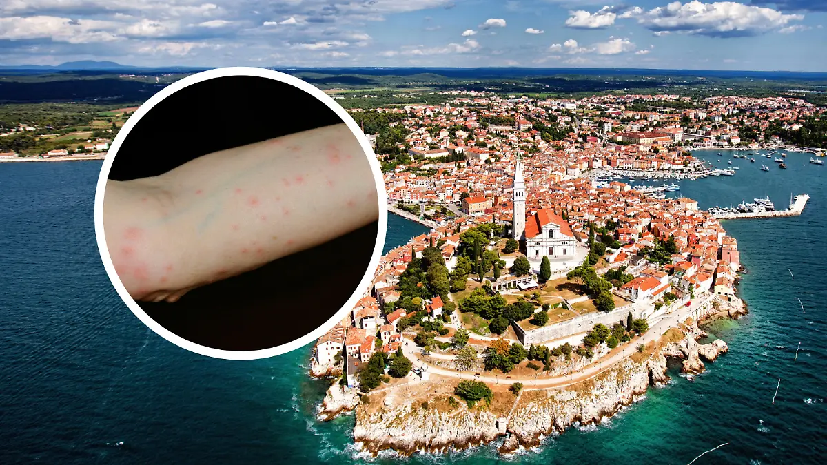 Istrien – eines DER Urlaubsziele der Deutschen. Nur blöd, dass sich hier seit August zahlreiche Milben tummeln, die Hautausschläge verursachen. (Symbolbild)