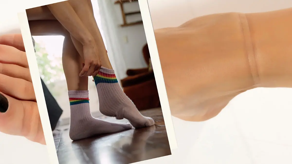 Mist, schon wieder Druckstellen an Fuß und Bein wegen der blöden Socken. Aber woher kommen die Abdrücke eigentlich?