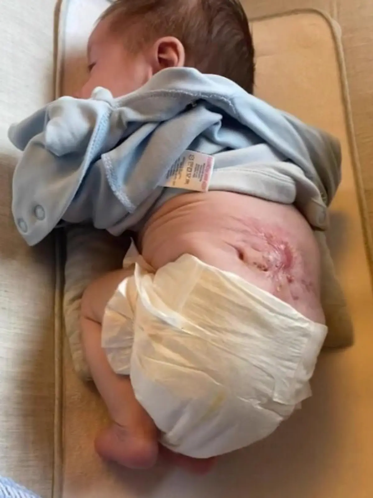Bild zu: "Baby Luca (2) erblickt zweimal das Licht der Welt"