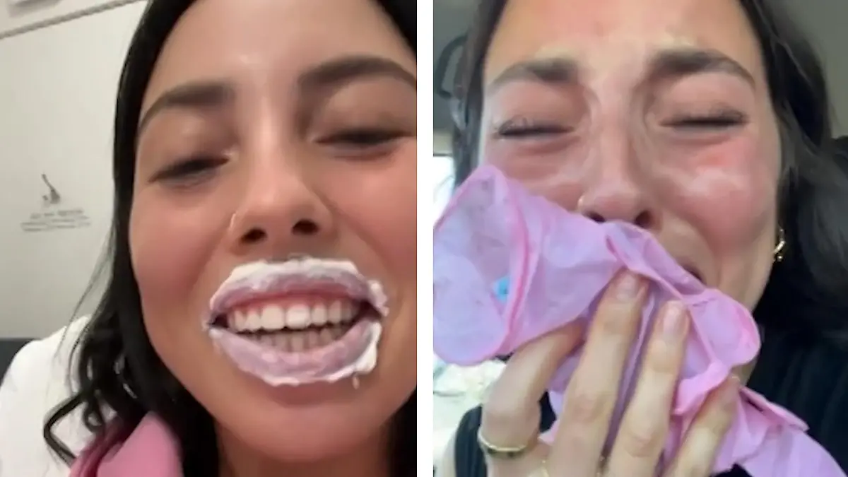 Oh, du fettes Ding! Frau bekommt nach Schönheits-OP einen Heulkrampf. So anschwellen sollte es nicht!