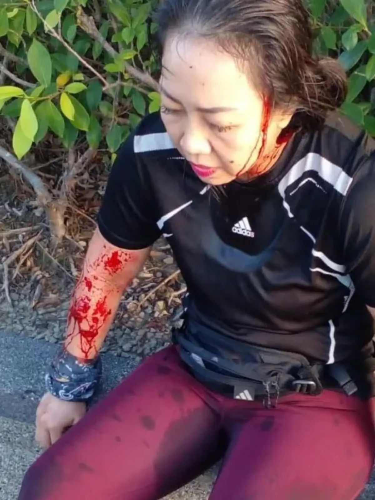 Eine Joggerin aus Malaysia wird von einer aggressiven Ottermeute blutig gebissen. 