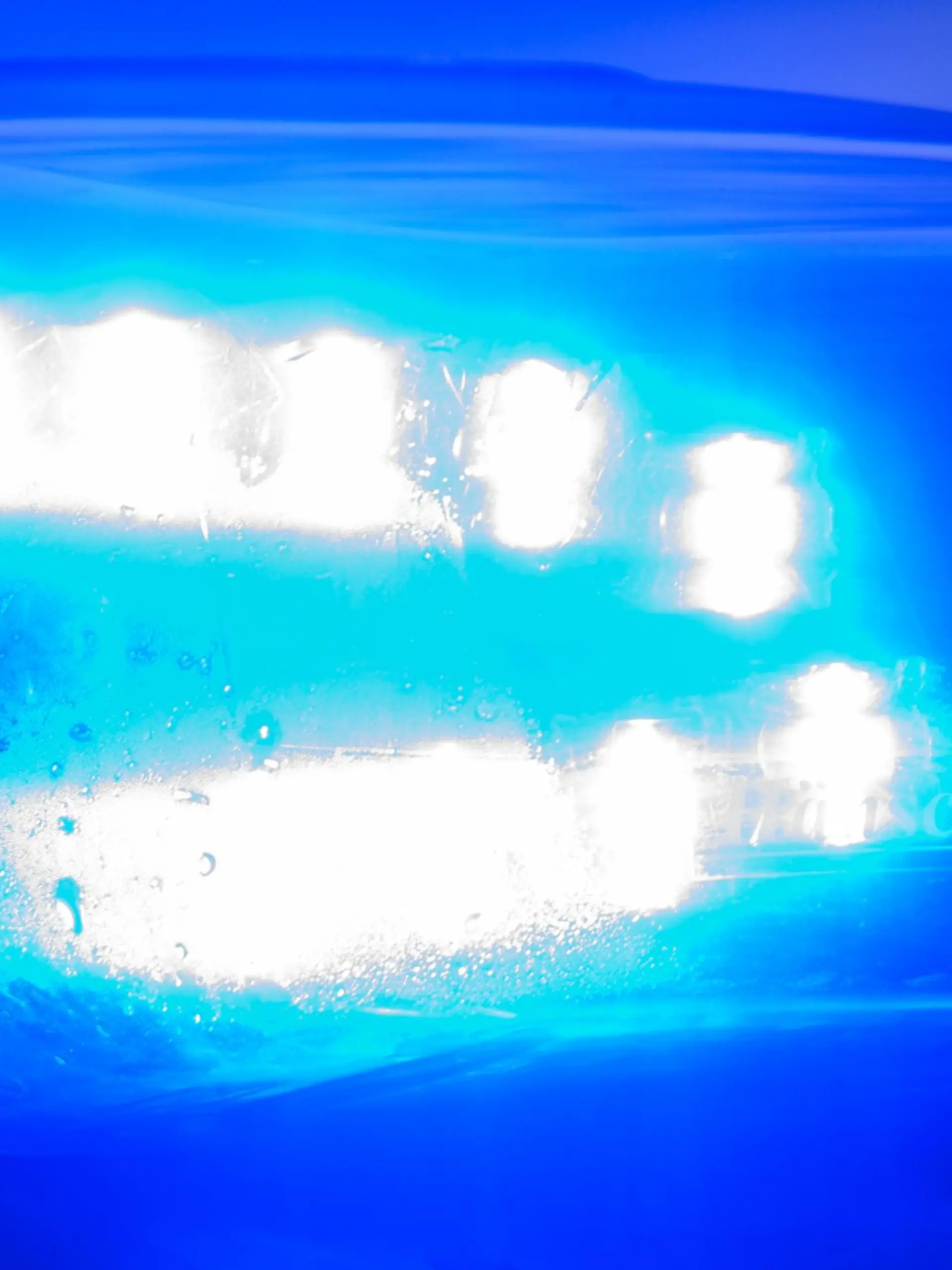 Bild zu: "Mann (68) in Cuxhaven mit Benzin übergossen und angezündet"