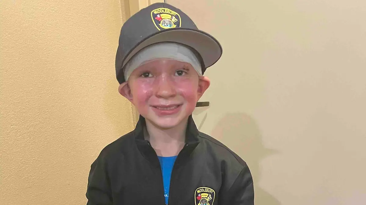 Dominick Feuerball Gesicht Connecticut
