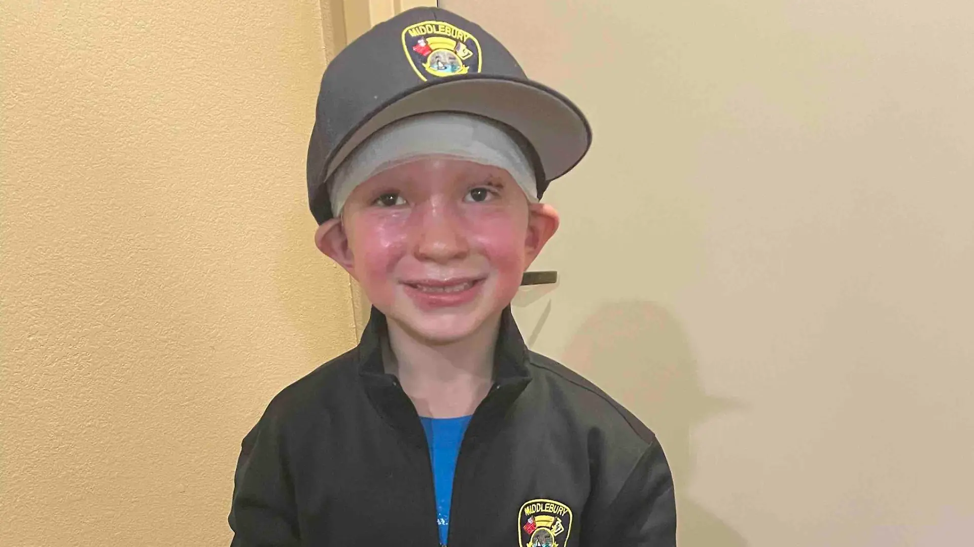 Dominick Feuerball Gesicht Connecticut