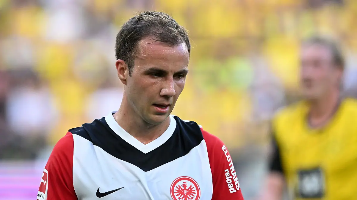 Mario Götze mit deutlich sichtbaren Geheimratsecken.
