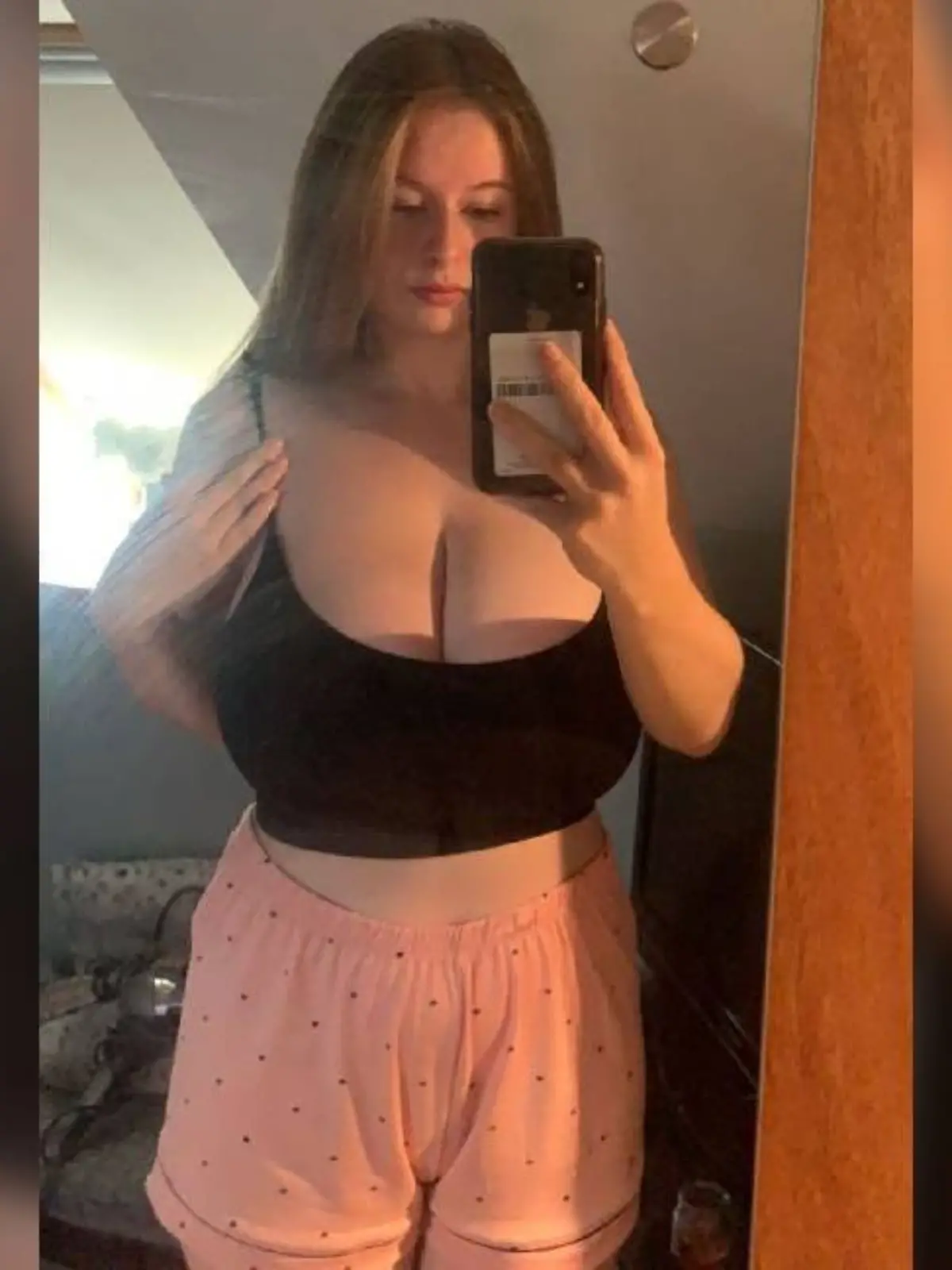 Paige Harvey vor der OP